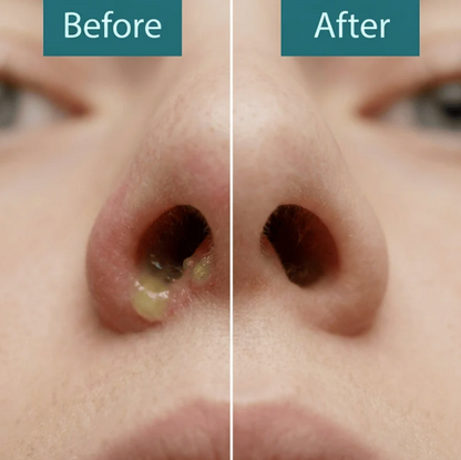 Golden Glow Nasal Cleanser